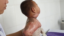 nga vao noi lau be 2 tuoi bi bong nang toan bo co nguc