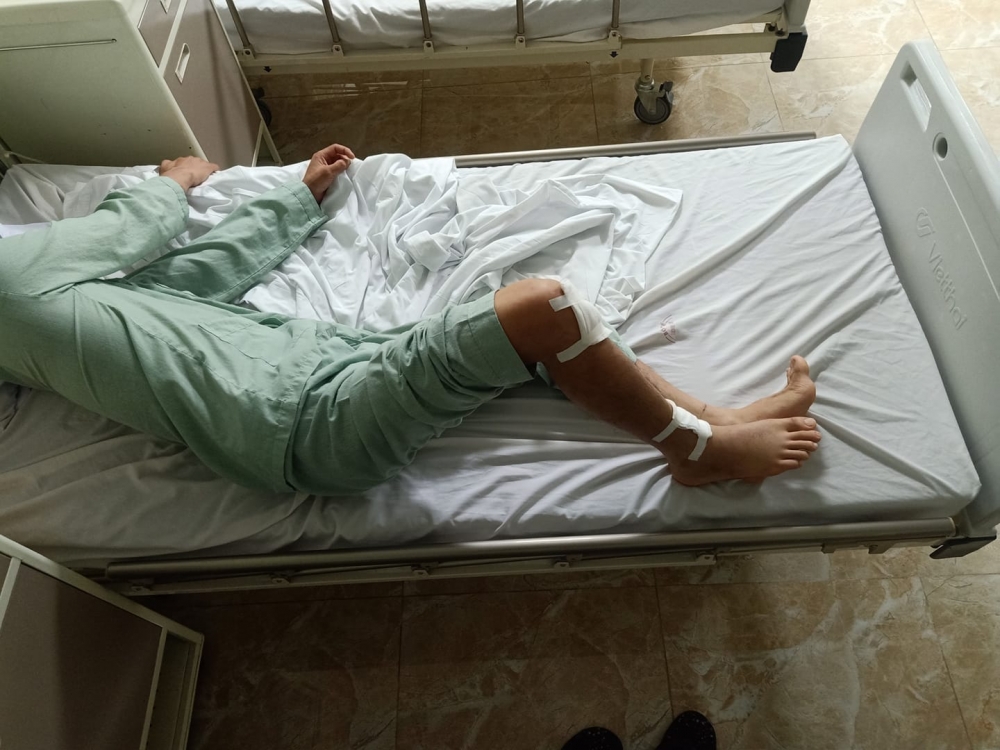 Cú va chạm khó hiểu khiến nam thanh niên Grab gẫy chân