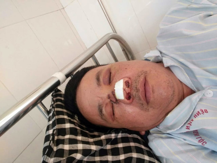 duoi theo 2 doi tuong trom cho truong cong an xa bi cau tac nem gay mui