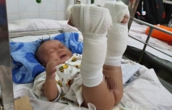 can ngan 2 con trai danh nhau bo me bi chem thuong vong