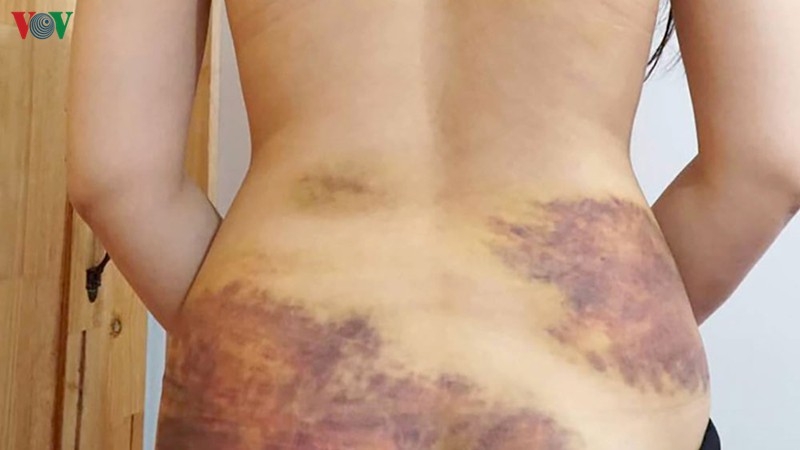 thay vo goi dien thoai chong noi con ghen danh dap da man