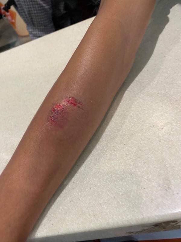 bi xu ly vi mang hanh ly qua can nang nu hanh khach lao vao can nhan vien hang khong