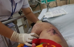chu quan ca phe tra tan da man nu tiep vien vi khong chiu kich duc co the khoi to toi giet nguoi