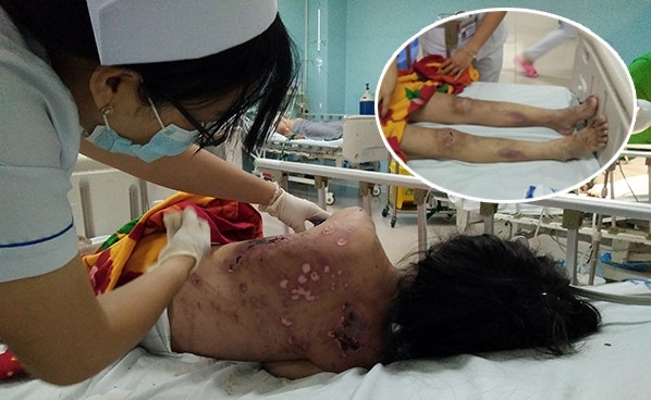 chu quan ca phe tra tan da man nu tiep vien vi khong chiu kich duc co the khoi to toi giet nguoi
