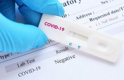 oxfam dna phai hanh dong cung nhau de vuot qua dich covid 19