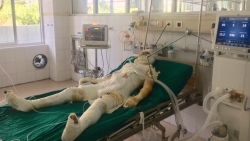 Vụ tẩm xăng thiêu sống cả nhà người tình: Bé 2 tuổi đã tử vong