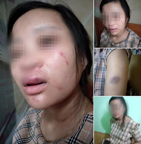 thai phu 8 thang bi chong danh bam dap vi mua do online