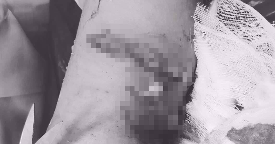 chu quan nghi no khong can dau be trai 7 tuoi bi cho can khau 70 mui