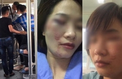 video tai xe o to bi nhom con do dung tuyp sat danh toi tap tren de o ha noi
