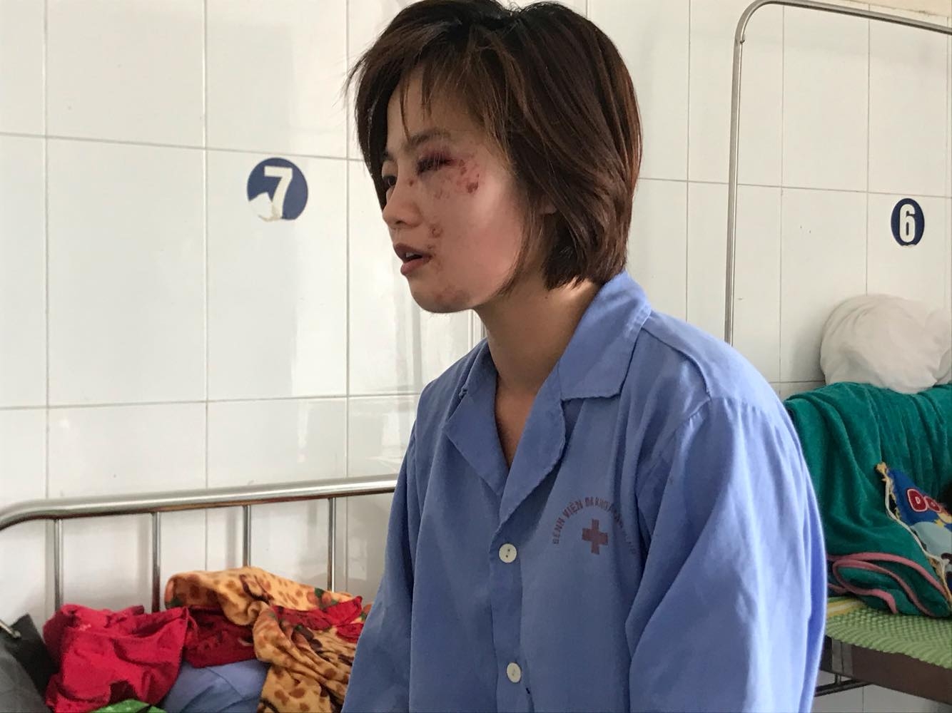 nhom thanh nien danh nu nhan vien xe buyt nhap vien da bo tron khoi dia phuong