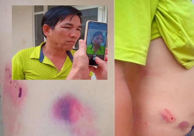 vi sao chanh van phong huyen uy danh lai xe nhap vien khong bi khoi to