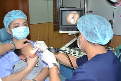 Nhét hạt cườm vào mũi, bé gái khiến cả nhà 1 phen hú vía