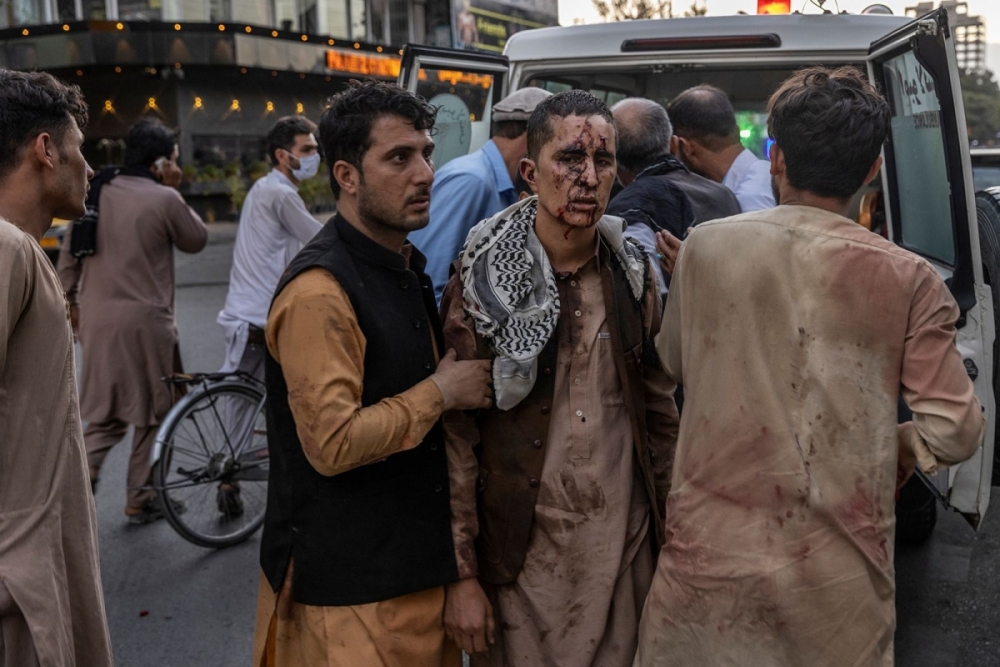Ảnh: Kabul tang thương và hỗn loạn sau vụ đánh bom đẫm máu