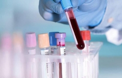 Việt Nam sắp có test kit xét nghiệm nhanh virus COVID-19?