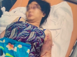 Khởi tố, bắt tạm giam kẻ đánh đập dã man cô gái 18 tuổi sảy thai