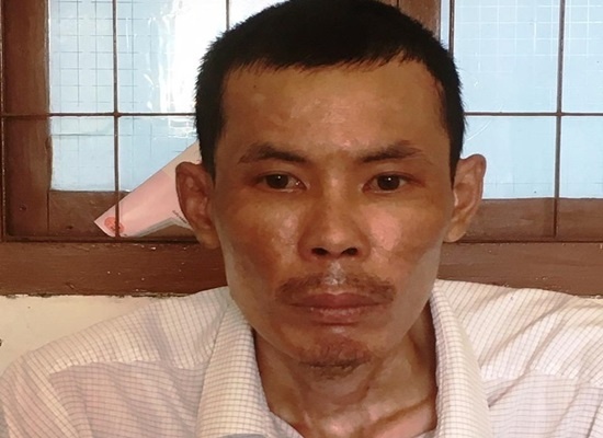 Không chịu nấu cơm, vợ bị chồng nhẫn tâm thiêu sống khong chiu nau com vo bi chong nhan tam thieu song