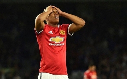 nhung phuong phap moi nhat trong dieu tri ung thu xuong