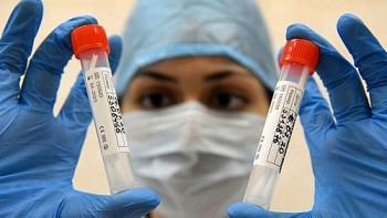 Nga sản xuất vaccine ngừa COVID-19 đầu tiên 
