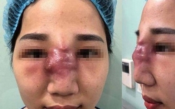 Xử lý nghiêm các thẩm mỹ viện, spa quảng cáo khám chữa bệnh trái phép