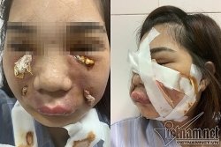 Dẹp loạn phẫu thuật thẩm mỹ: Sẽ kiếm tra đột xuất các cơ sở làm đẹp