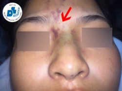 Sở Y Tế thành phố Hồ Chí Minh tăng cường quản lý dịch vụ thẩm mỹ