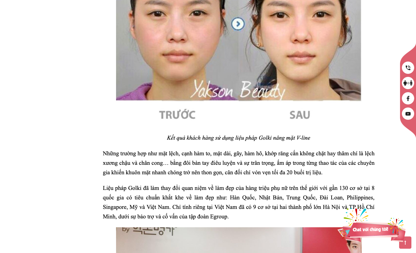 yakson beauty co the nan thang chan khong can phau thuat