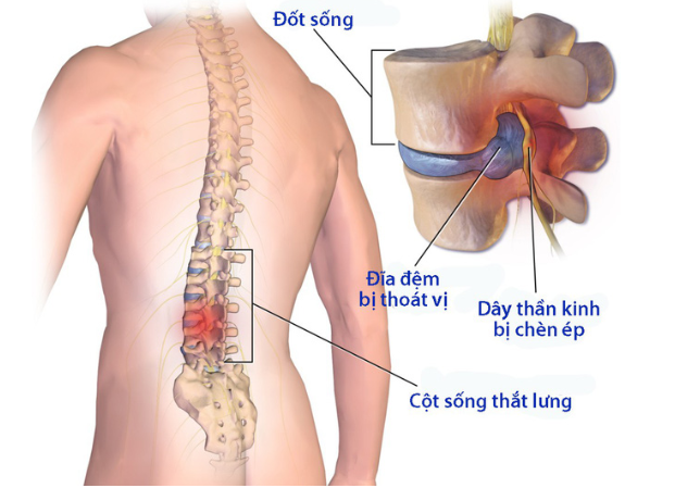 yoga co tac dung nhu the nao doi voi cot song