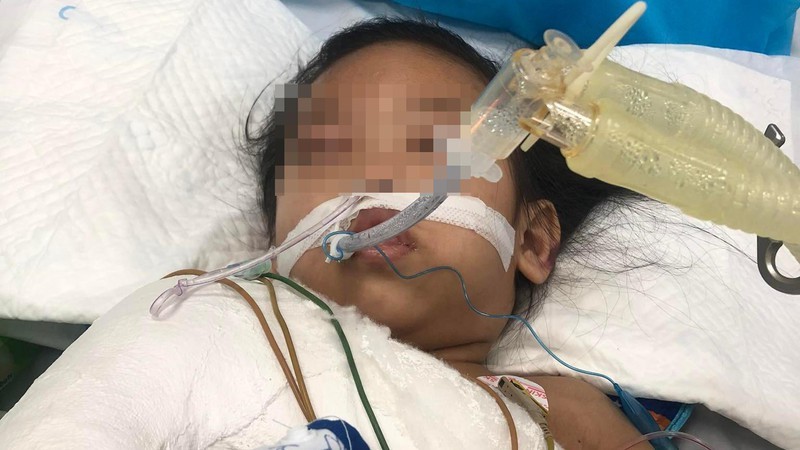 Vụ việc cháu bé 3 tuổi ở Hà Nội bị người tình của mẹ đóng đinh vào đầu gây phẫn nộ thời gian qua. Ảnh: Internet