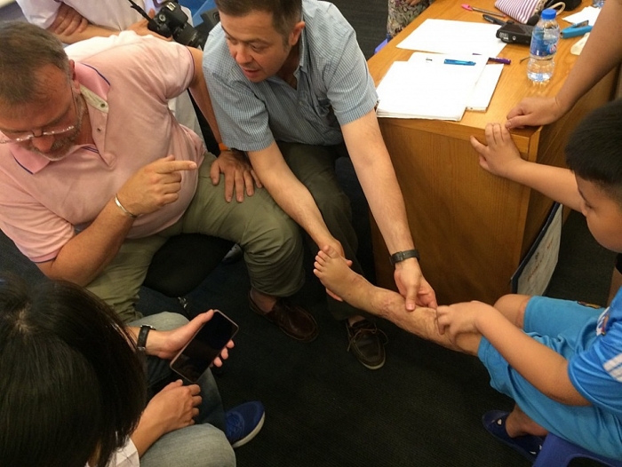 chuyen gia nuoc ngoai mang lai hi vong cho tre bi seo di chung bong