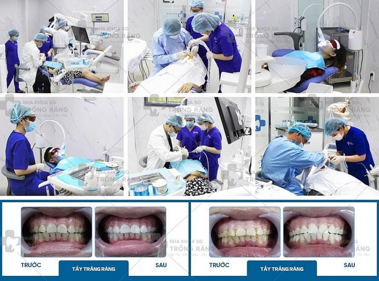 Nha khoa trồng răng Sài Gòn – Địa chỉ trồng răng uy tín, chất lượng
