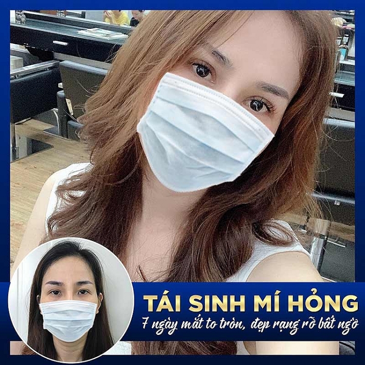 Sửa mí hỏng lấy lại “nét đẹp tâm hồn” cùng bệnh viện thẩm mỹ Gangwhoo
