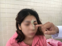 binh phuoc da xac dinh danh tinh thi the khong dau trong vuon dieu