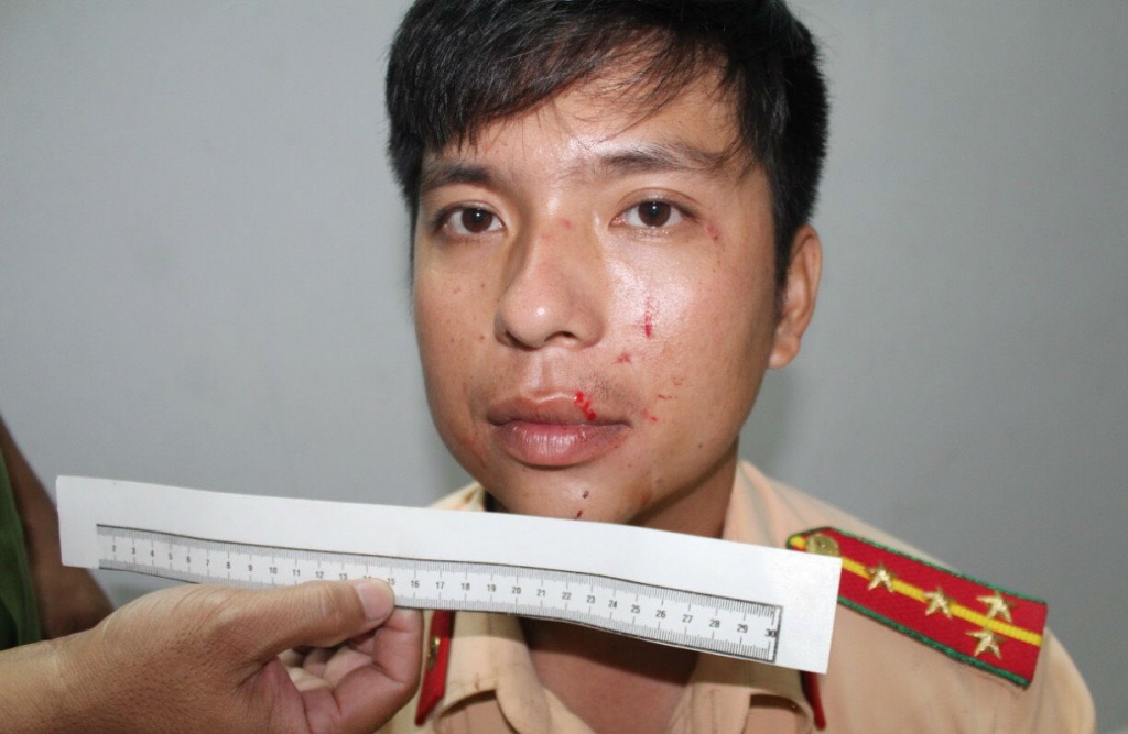 tam giu doi tuong tu xung canh sat hinh su danh canh sat giao thong o can tho