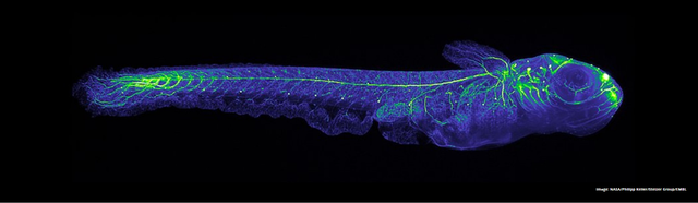 hoi chung thoai hoa xuong khong chi o nhung nha du hanh vu tru ma con xuat hien ca tren loai ca
