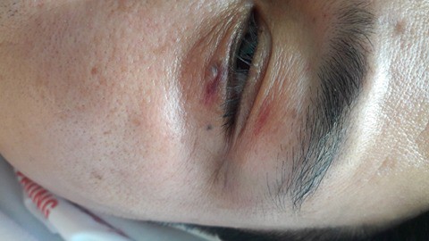 hai phong 5 thanh nien truy sat mot nguoi dan ong ngay giua ban ngay