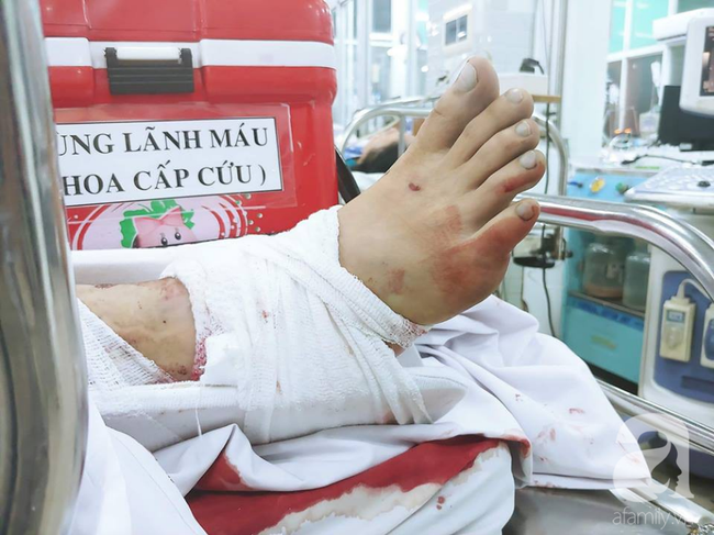 thong tin moi nhat 2 nan nhan trong vu container tong loat xe may o long an sap duoc xuat vien
