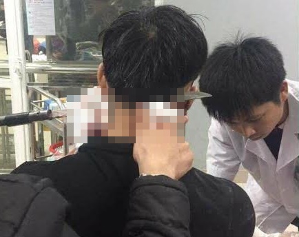 bac giang cuu song nam thanh nien bi dao nhon dam xuyen gay