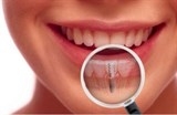 ky thuat cay ghep implant nguyen ham an toan dat tieu chuan quoc te