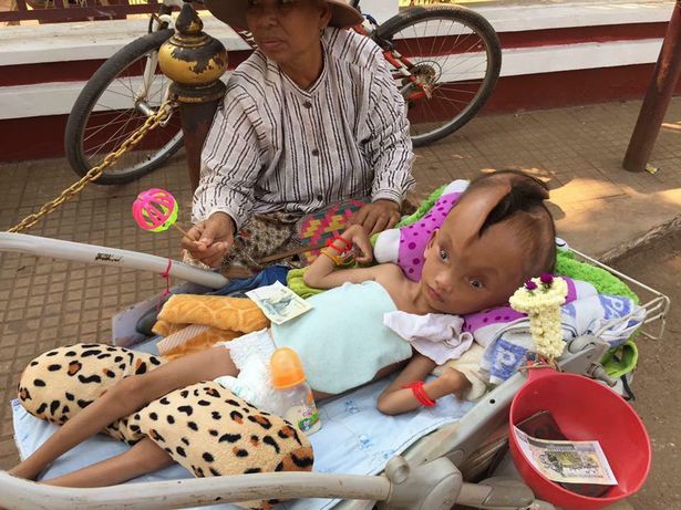 be trai dang thuong bi nut doi dau ma khong ro nguyen do