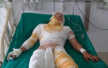 tinh canh khon kho cua nguoi dan ong dan toc mong bi dien cao the giat bong toan than