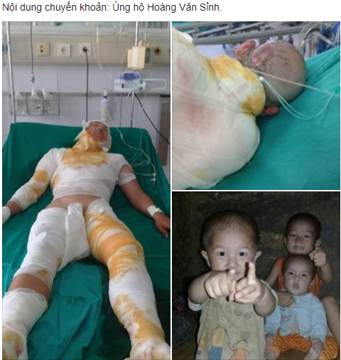 tinh canh khon kho cua nguoi dan ong dan toc mong bi dien cao the giat bong toan than