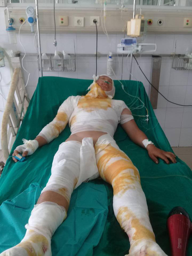 tinh canh khon kho cua nguoi dan ong dan toc mong bi dien cao the giat bong toan than