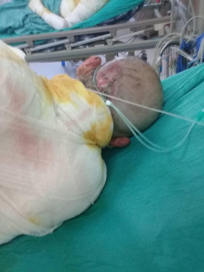 tinh canh khon kho cua nguoi dan ong dan toc mong bi dien cao the giat bong toan than