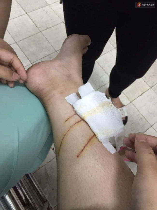 20 thanh nien mang theo hung khi xong vao quan tra sua truy sat thieu nu 16 tuoi