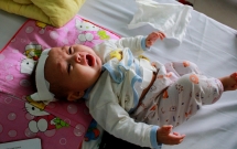 xot thuong be gai 6 thang tuoi chi nang 4kg lai phai chiu nhieu di tat tren co the