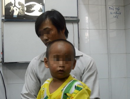 gap loi ken do choi ra khoi phoi be trai 4 tuoi