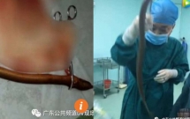 nguoi dan ong nguy kich vi nuot luon song chua tao bon