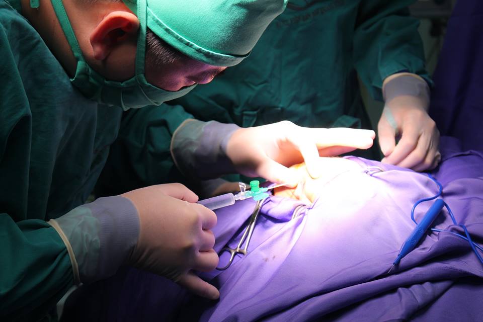 tao hinh hau mon thanh cong cho tre chua day 1 ngay tuoi