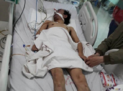 thai binh dieu tra vu nguoi dan ong nhap vien cap cuu sau khi bi tam giu 4 ngay