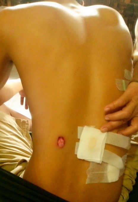 csgt ban dan cao su vao dan chi bi xu ly nhe